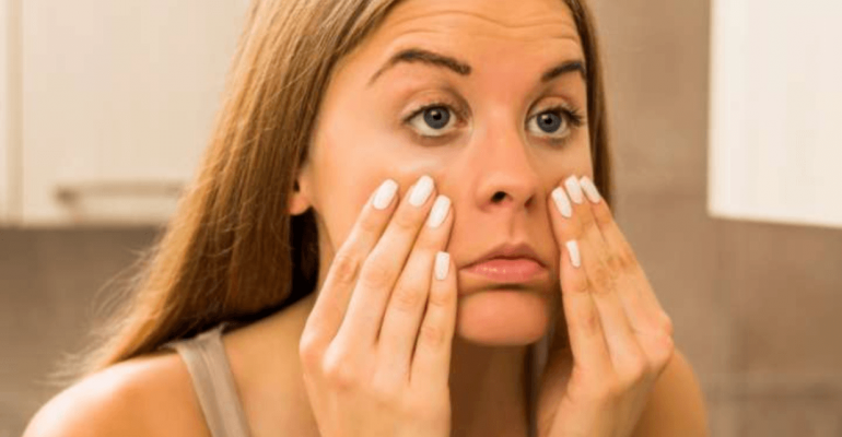 Massagem na região dos olhos ajuda a prevenir as olheiras?