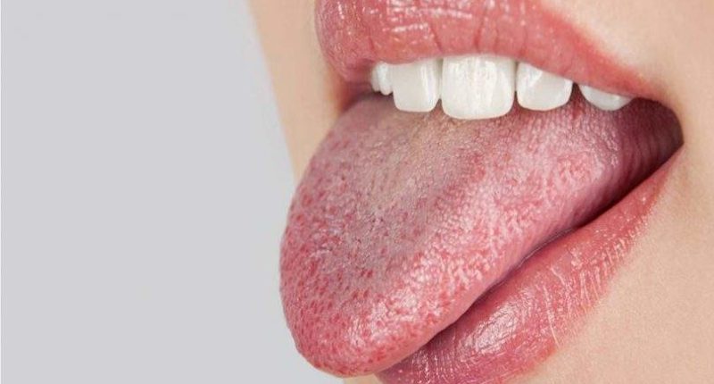 Acupuntura reduzindo a xerostomia e hipofluxo salivar